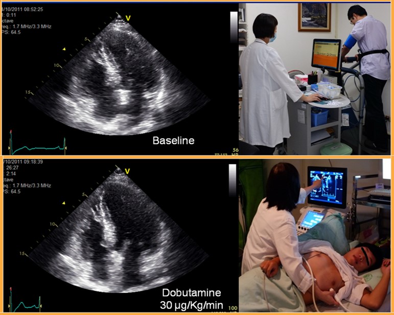 負荷心臟超音波檢查