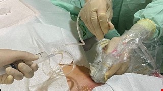 Liver Biopsy 肝臟切片會危險嗎？我該注意什麼？