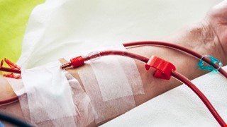 How to Protect Your Vascular Access 如何保護您的洗腎血管通路