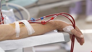 Possible Complications of Hemodialysis 洗腎可能會面臨的併發症