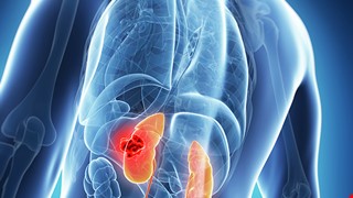 Renal ultrasound 腎臟超音波檢查說明