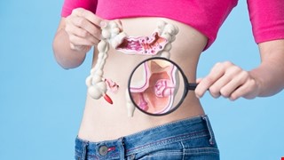 Home Care for patients of Colorectal surgery 大腸直腸肛門外科出院病人照護