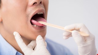 Early Diagnosis of Oral Cancer by Oral Self-examination 口腔自我檢查 早期診斷口腔癌