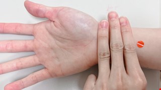 Acupressure Tips for Helping Patients with Delirium 幫助譫妄症病人穴位按摩須知