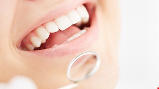 氟化氨銀（SDF）治療注意事項