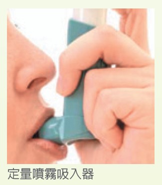 定量噴霧吸入器 