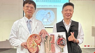 高血壓病17載 成功逆轉竟不藥而癒！ 醫精準揪出「原發性醛固酮過高症」 「續發性高血壓」全台估53萬人 找原因可斷病病灶