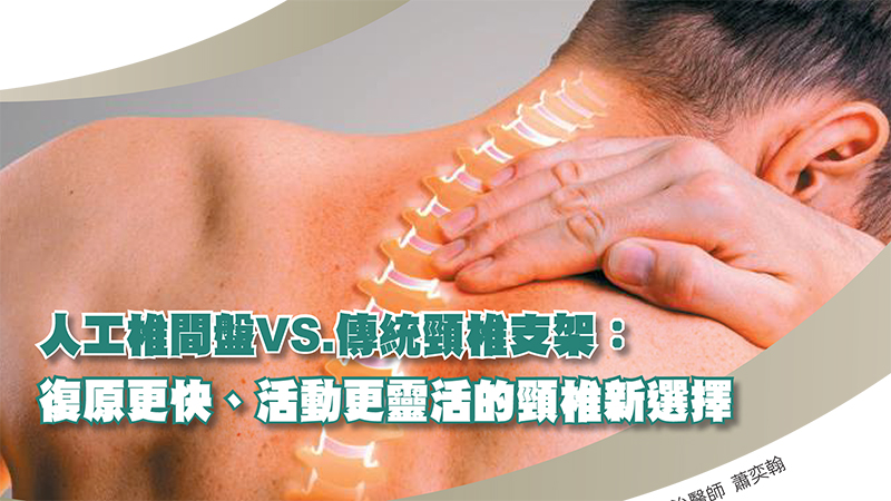人工椎間盤 vs. 傳統頸椎支架：復原更快、活動更靈活的頸椎新選擇