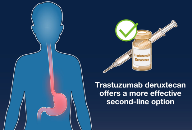 Trastuzumab Deruxtecan or Ramucirumab plus Paclitaxel in Gastric Cancer