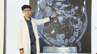 小小膽結石恐引發壞死性胰臟炎 中醫大附醫多專科團隊合力逆轉重症 大幅提升存活率